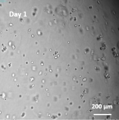 VitroGel COLを用いた膠芽腫細胞（SNB-75）の三次元培養1